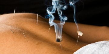 Acupuncture Services in Asheville NC