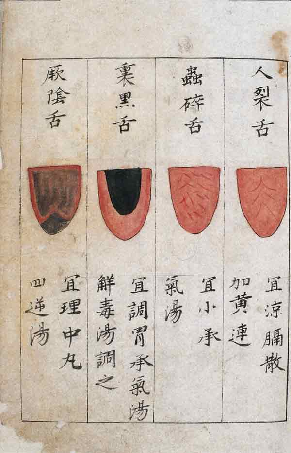 Tongue chart with notes in Chinese