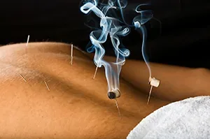 Burning Moxibustion Herbs